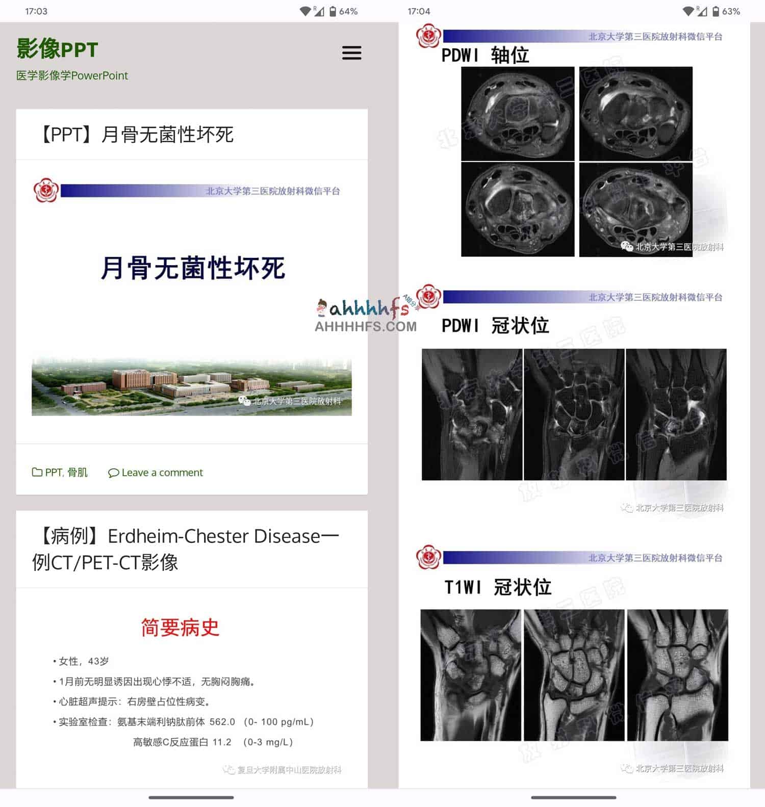 图片[1]-医学影像ppt资源下载中心 – 影像PPT-资源网